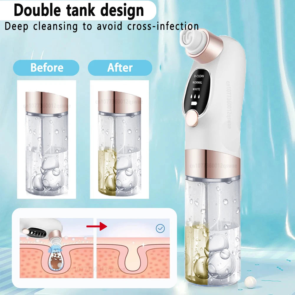 Blackhead Remover Pore Vacuum