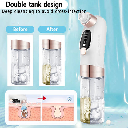 Blackhead Remover Pore Vacuum