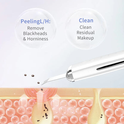 Ultrasonic Skin Scraper for Deep Cleansing