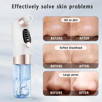 Blackhead Remover Pore Vacuum